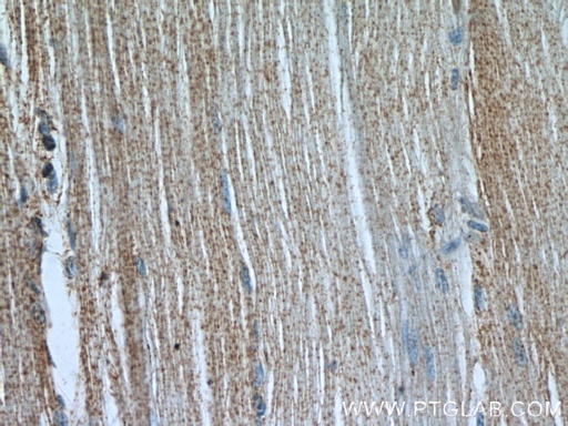 [22279-1-AP-20UL] CACNA1S Polyclonal antibody