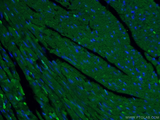 [22281-1-AP-20UL] MYH6 Polyclonal antibody