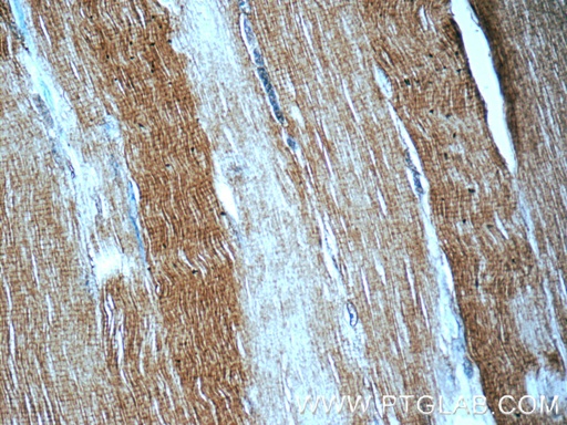 [22282-1-AP-150UL] MYH1-motor domain Polyclonal antibody