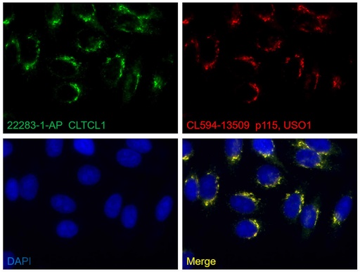 [22283-1-AP-20UL] CLTCL1 Polyclonal antibody