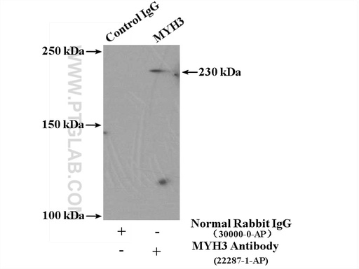 [22287-1-AP-150UL] MYH3 Polyclonal antibody