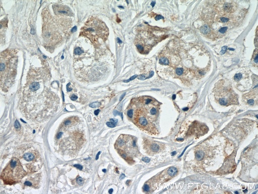 [22289-1-AP-20UL] ARF3 Polyclonal antibody