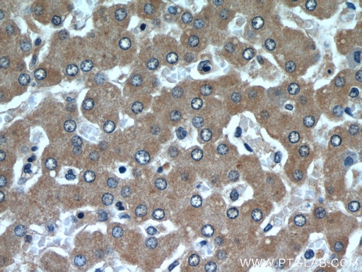 [22292-1-AP-20UL] SAR1B Polyclonal antibody