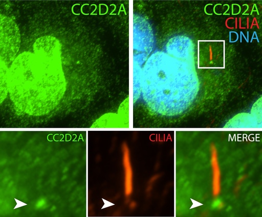 [22293-1-AP-150UL] CC2D2A Polyclonal antibody