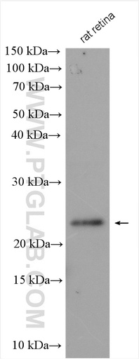 [22298-1-AP-150UL] GCAP2 Polyclonal antibody