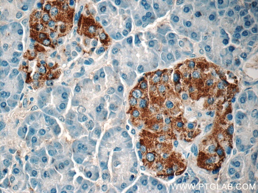 [22305-1-AP-20UL] Amylin Polyclonal antibody