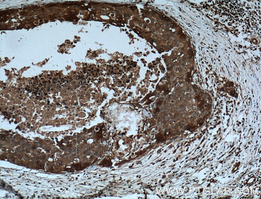 [22306-1-AP-20UL] CCL24/Eotaxin 2 Polyclonal antibody