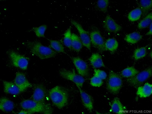 [22308-1-AP-20UL] TGF Alpha Polyclonal antibody
