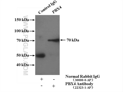 [22323-1-AP-20UL] PBX4 Polyclonal antibody
