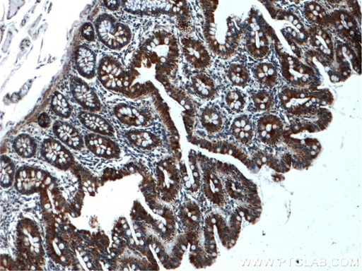 [22326-1-AP-150UL] WNK4 Polyclonal antibody