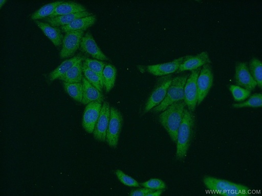 [22329-1-AP-150UL] SMN Polyclonal antibody