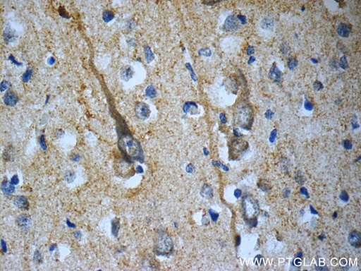 [22334-1-AP-150UL] TACR3 Polyclonal antibody