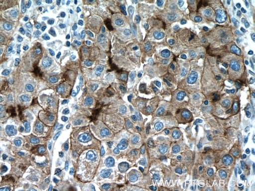 [22336-1-AP-150UL] P glycoprotein Polyclonal antibody