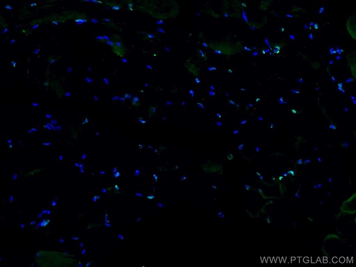 [22337-1-AP-20UL] TCF4 Polyclonal antibody