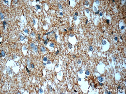 [22338-1-AP-150UL] ATP1B2 Polyclonal antibody