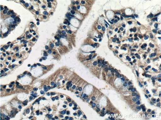 [22339-1-AP-20UL] BTG2 Polyclonal antibody