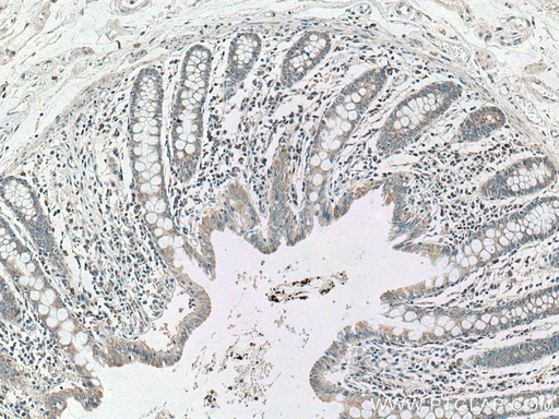 [22342-1-AP-150UL] CCL17 Polyclonal antibody
