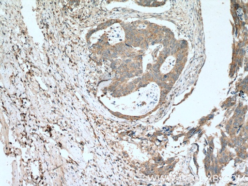 [22355-1-AP-20UL] MIG Polyclonal antibody