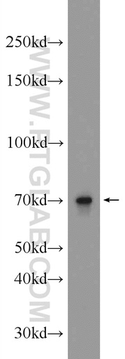 [22358-1-AP-20UL] ALX3 Polyclonal antibody