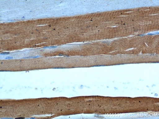 [22361-1-AP-20UL] ATP2A1 Polyclonal antibody