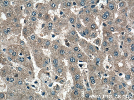 [22371-1-AP-20UL] GYS2 Polyclonal antibody