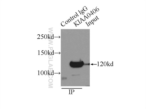 [22381-1-AP-20UL] TTI1 Polyclonal antibody