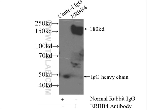 [22387-1-AP-20UL] ERBB4 Polyclonal antibody