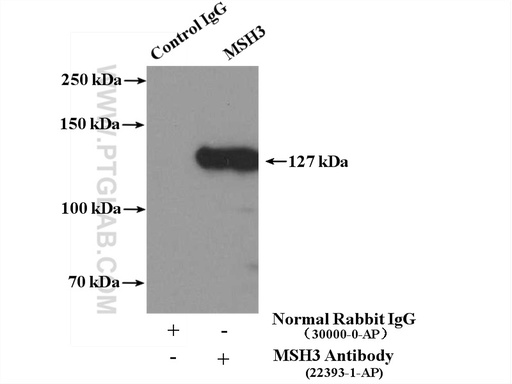 [22393-1-AP-150UL] MSH3 Polyclonal antibody