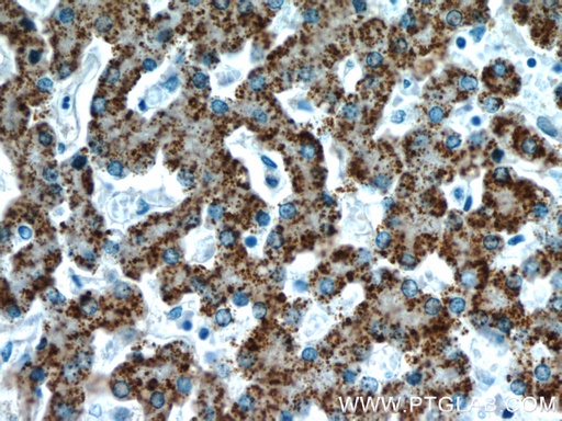 [22394-1-AP-20UL] AGXT Polyclonal antibody