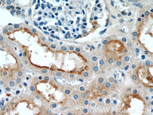 [22398-1-AP-20UL] GRIP1 Polyclonal antibody