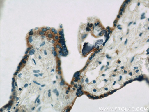 [22401-1-AP-20UL] ACSL4/FACL4 Polyclonal antibody