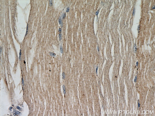 [22433-1-AP-20UL] ABLIM2 Polyclonal antibody