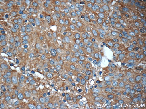 [22456-1-AP-150UL] PKLR Polyclonal antibody