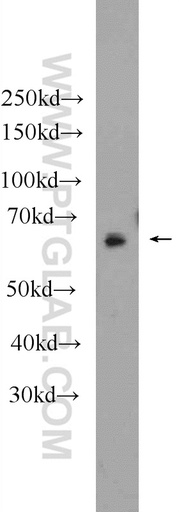 [22460-1-AP-150UL] NR5A2 Polyclonal antibody