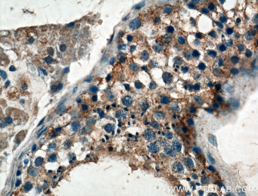 [22462-1-AP-150UL] GNRHR Polyclonal antibody