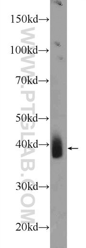 [22491-1-AP-20UL] NKX3-2 Polyclonal antibody