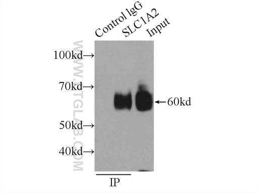 [22515-1-AP-20UL] EAAT2 Polyclonal antibody