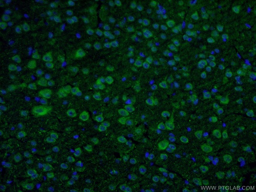 [22524-1-AP-20UL] DAT Polyclonal antibody
