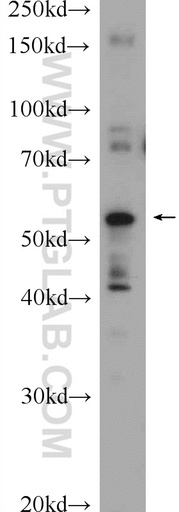 [22526-1-AP-150UL] ABHD15 Polyclonal antibody