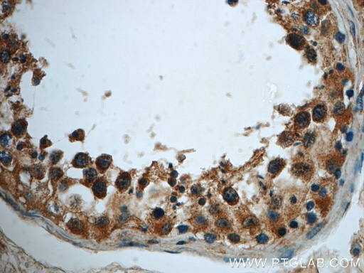 [22527-1-AP-20UL] TMEM168 Polyclonal antibody