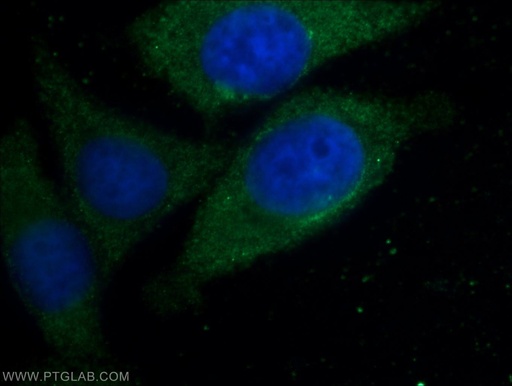 [22549-1-AP-20UL] GAB2 Polyclonal antibody