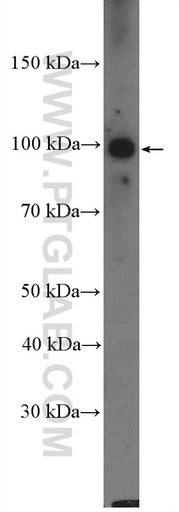 [22551-1-AP-150UL] RFX6 Polyclonal antibody