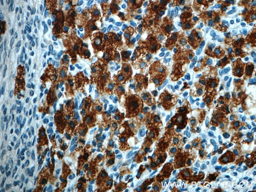 [22569-1-AP-150UL] C4orf49 Polyclonal antibody