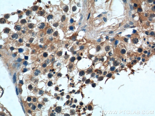[22587-1-AP-150UL] WBP2NL Polyclonal antibody