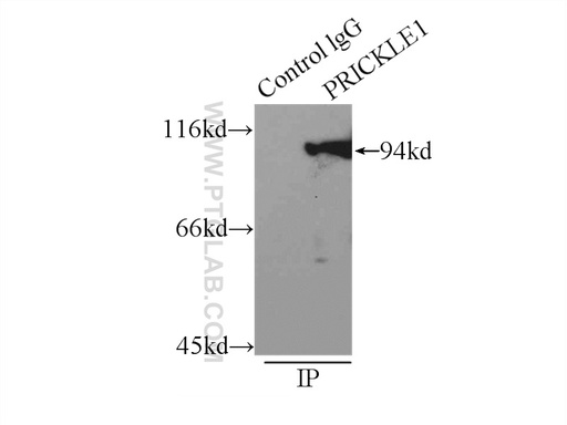 [22589-1-AP-150UL] PRICKLE1 Polyclonal antibody