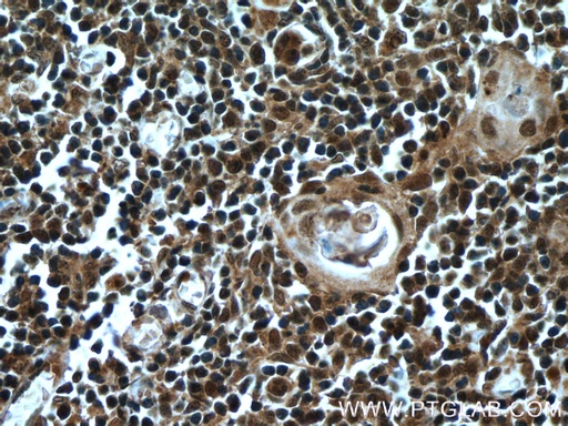 [22591-1-AP-20UL] KDM4D Polyclonal antibody