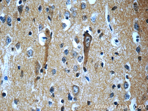 [22592-1-AP-20UL] SORLA Polyclonal antibody