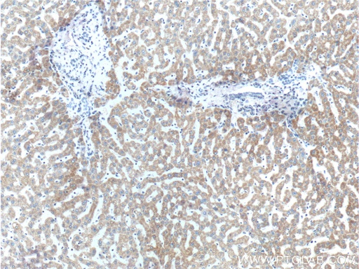 [22605-1-AP-20UL] FNDC3B Polyclonal antibody