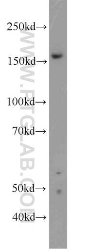 [22608-1-AP-150UL] ZZZ3 Polyclonal antibody