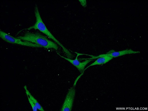 [22624-1-AP-20UL] PDE5A Polyclonal antibody
